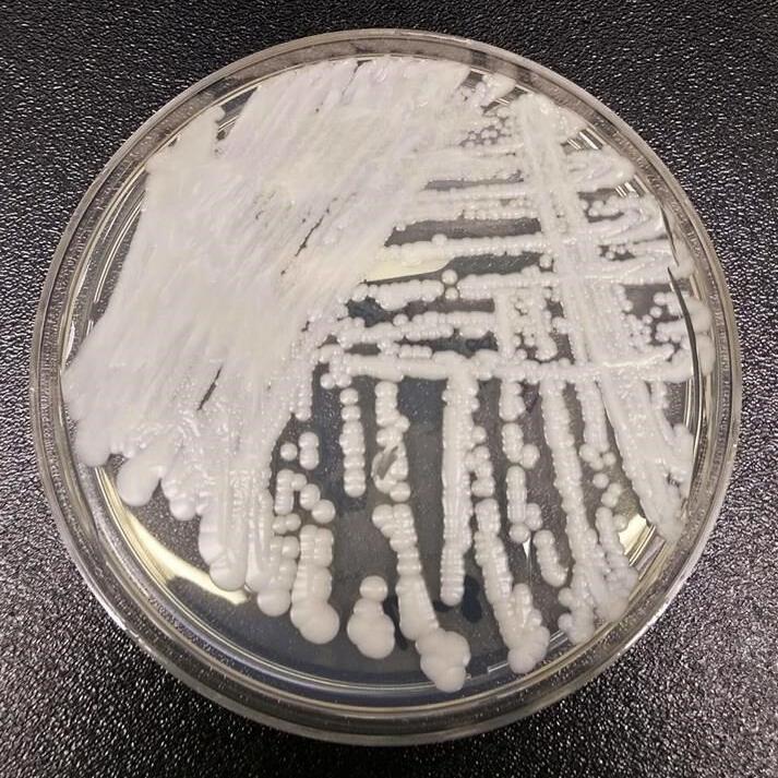 Superbug fungus cases rose dramatically during pandemic